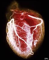 Рентгенографическое исследование сердца